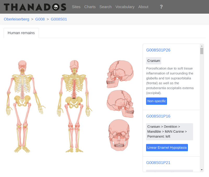 Human remains